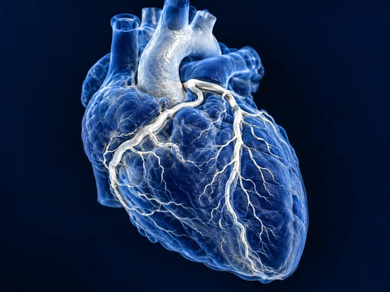 Illustration representing PTCA / Cath Lab / Angioplasty