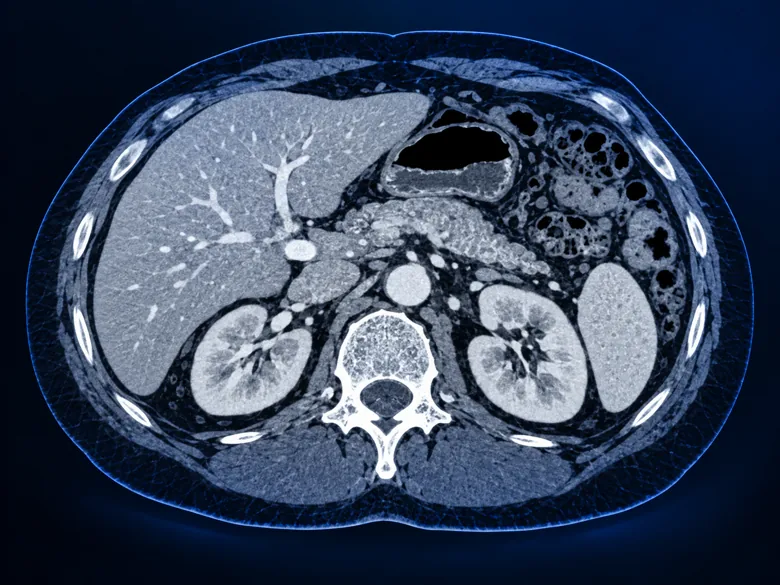 Illustration representing CT Abdomen and Pelvis