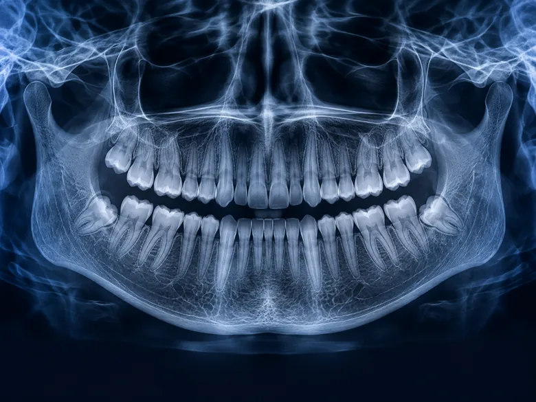 Illustration representing Dental Panoramic X-rays