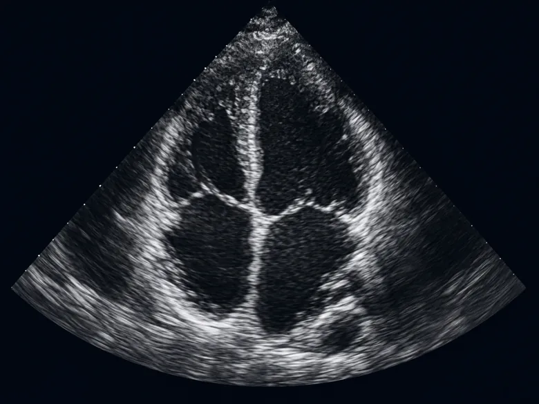 Illustration representing USG Cardio-Echo
