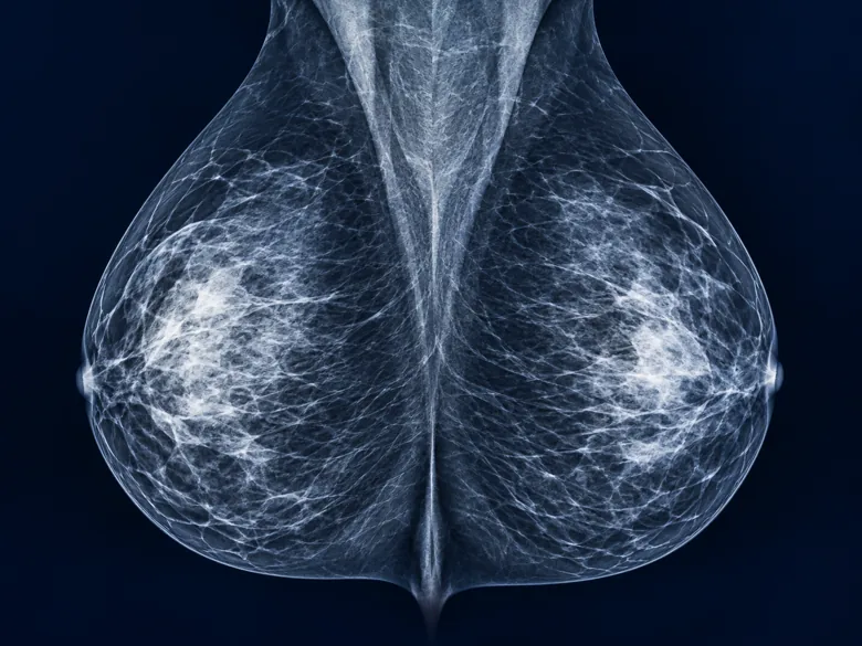 Illustration representing Mammography X-ray