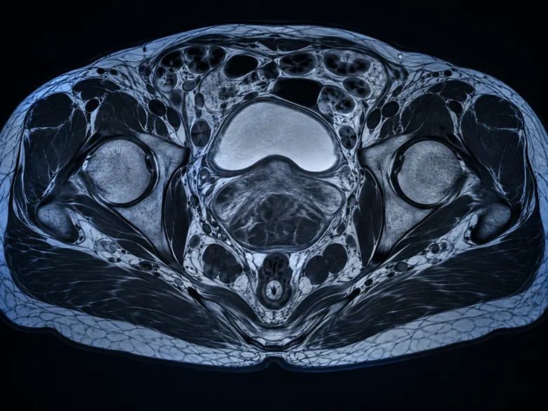 Illustration representing MRI Pelvis