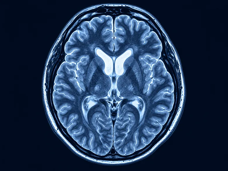 Illustration representing MRI Brain - Plain / Contrast