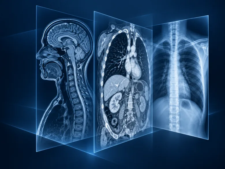 Illustration of the dataset category