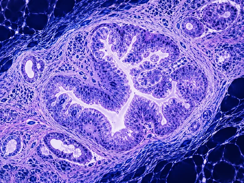 Illustration representing Structured Pathology Profiles