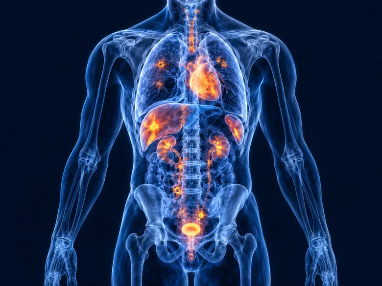 Illustration representing PET-CT