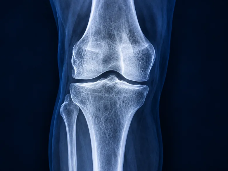 Illustration representing Knee X-ray